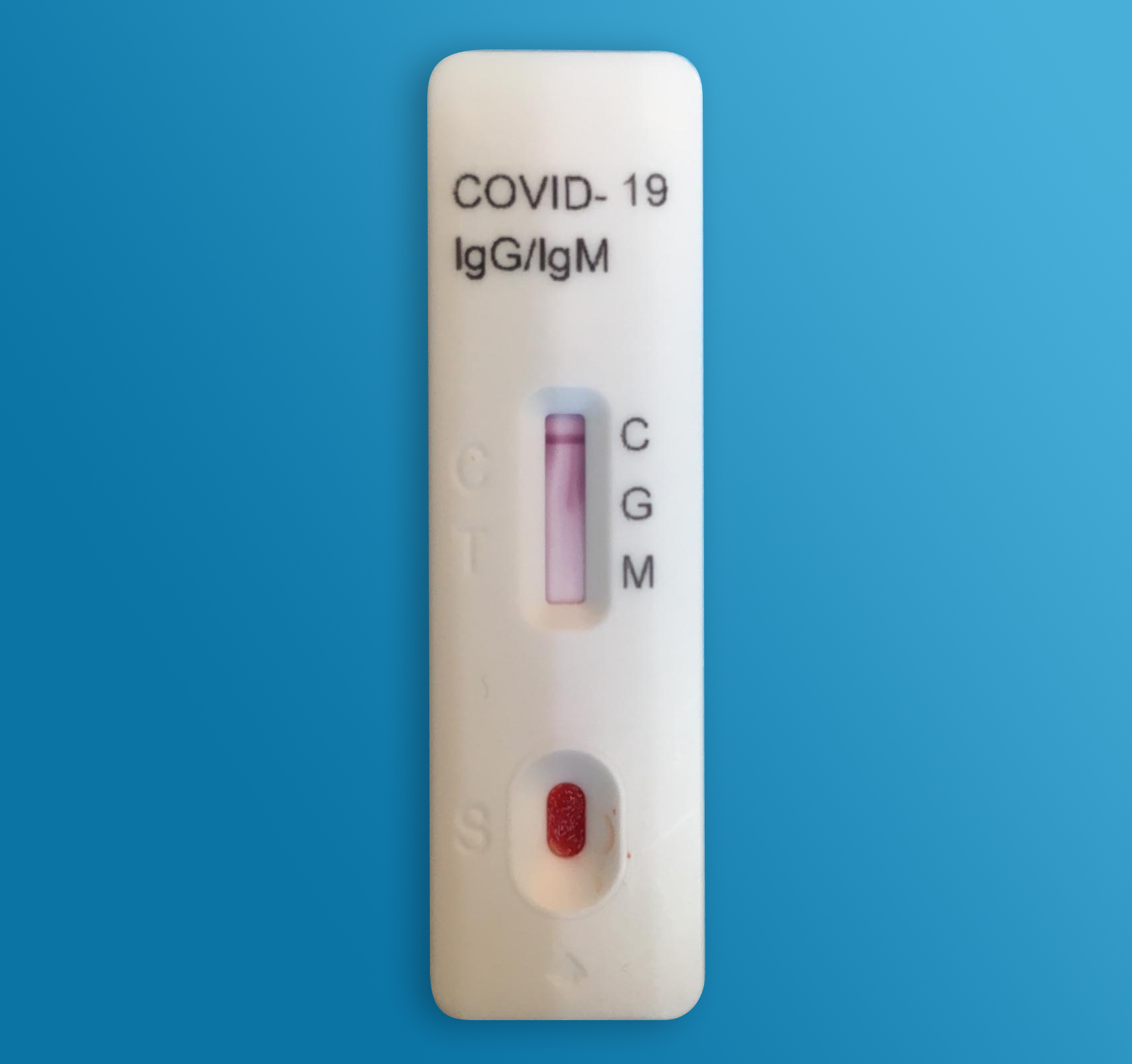 test sierologico covid-19