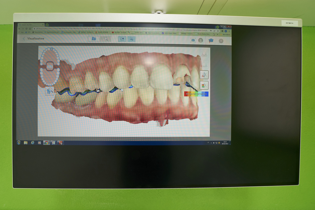 impronte dentali digitali