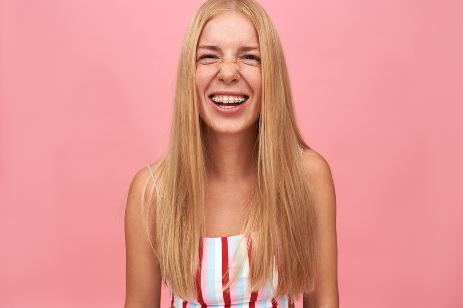 persona con apparecchio ai denti, ortodonzia per denti sovrapposti